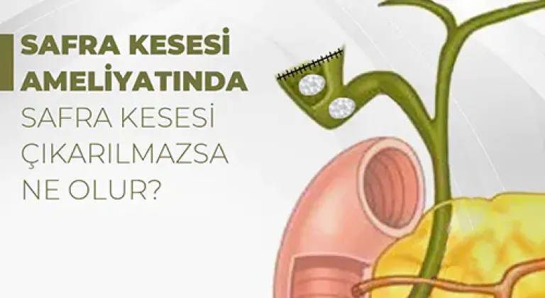 Safra kesesi ameliyatında kese tamamen çıkarılmazsa ne olur?